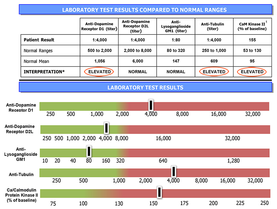 Cunningham Panel pretest for autoimmune epilepsy
