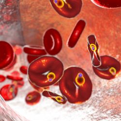 Babesiosis caused by Babesia duncani